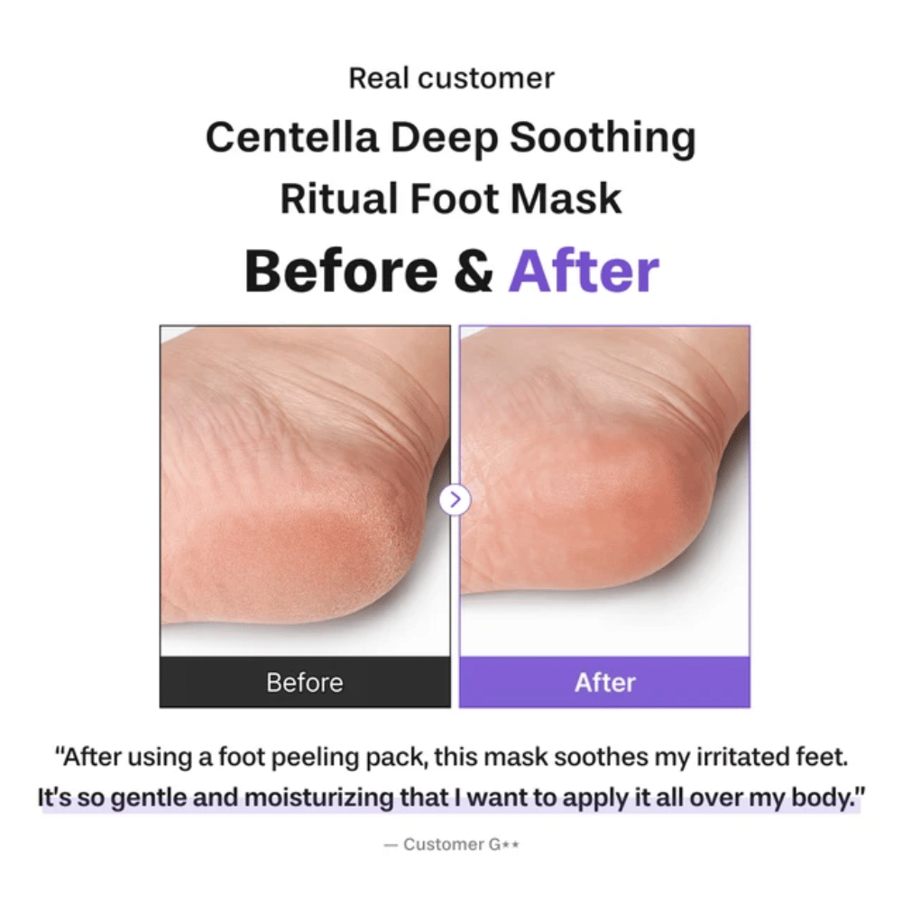 6. Baren Centella Deep Soothing Ritual Foot Mask – ennen ja jälkeen -kuva, joka näyttää pehmeämmän ja kosteutetumman kantapään käytön jälkeen