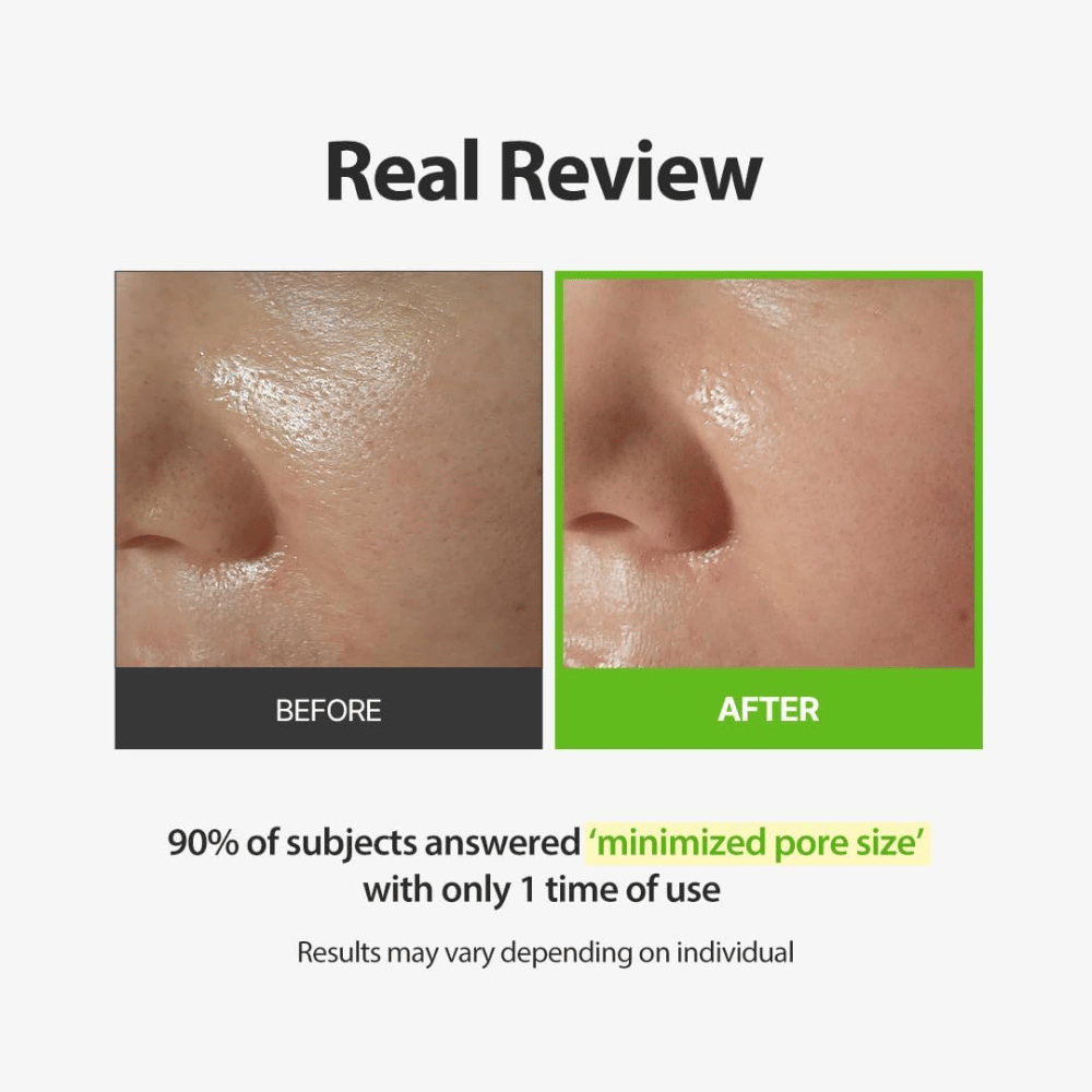 SUNGBOON EDITOR Green Tomato Pore Peeling Jumbo Pad – ennen ja jälkeen -kuva, jossa painotus näkyvissä huokosissa