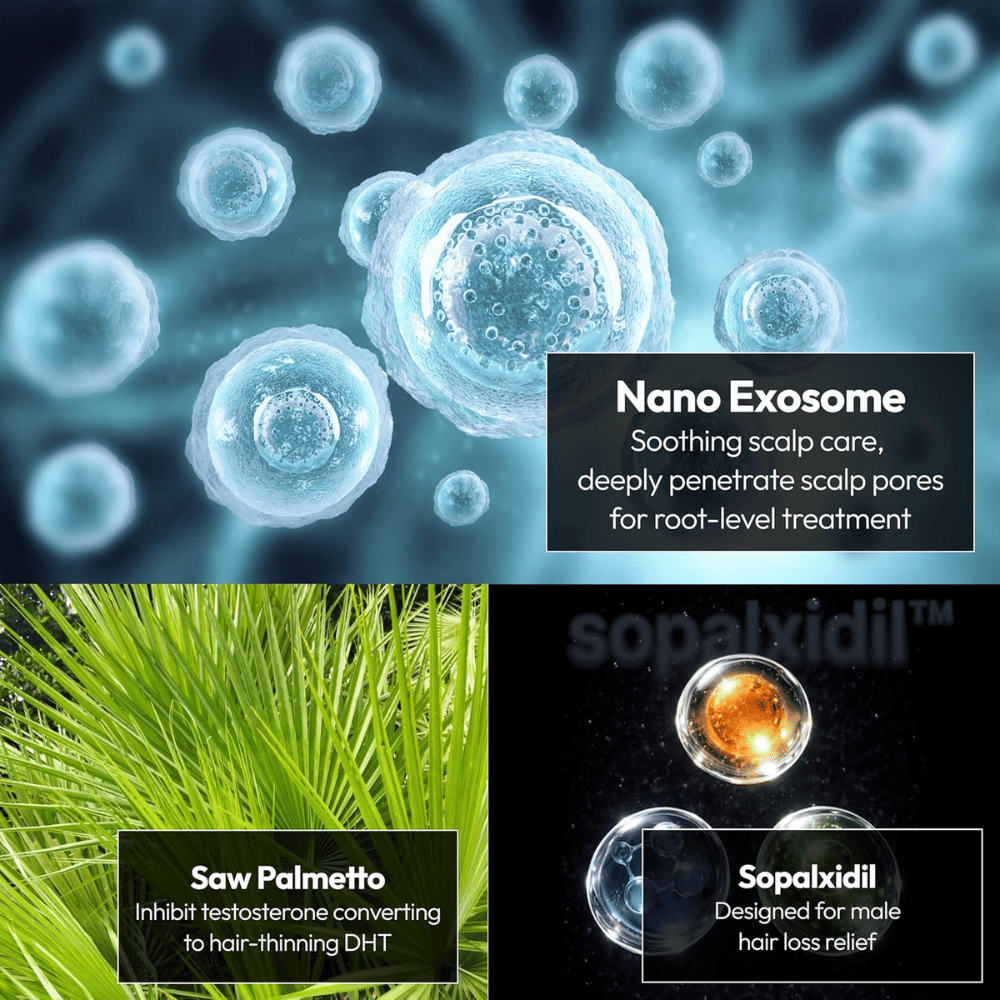 Kuva tuotteen avainainesosista, mukaan lukien nanoeksosomit, saw palmetto ja Sopalxidil™. Ainesosia korostetaan hiuspohjan hoidon tukemiseksi, DHT:hen liittyvän hiustenlähdön vähentämiseksi ja hiusten edellytysten vahvistamiseksi.