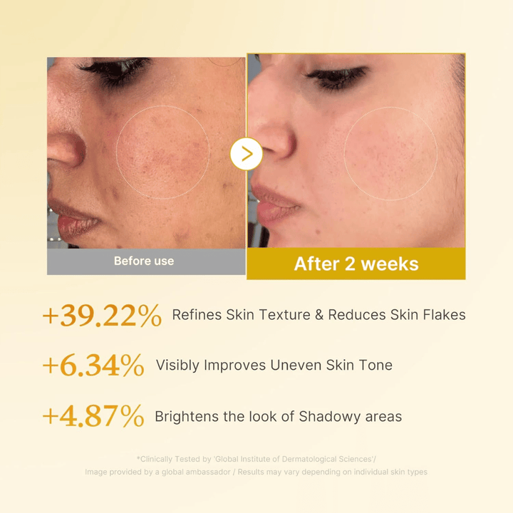 Ennen ja jälkeen -kuva tuotteelle Medicube Kojic Acid Turmeric Resurfacing Toner, joka näyttää parantuneen ihon rakenteen, tasaisemman ihonsävyn ja vähentyneet kuivat ihonhilseet kahden viikon käytön jälkeen.