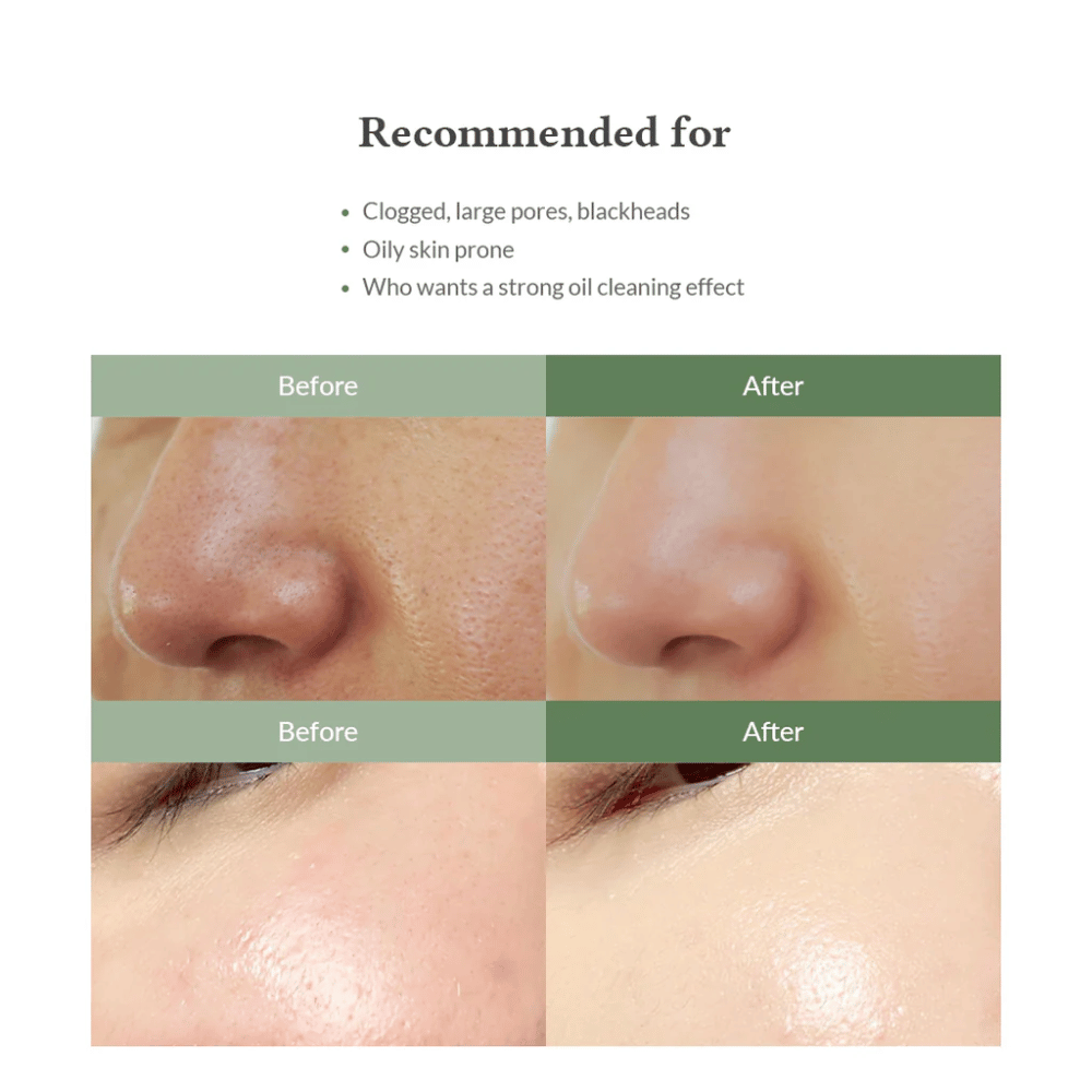 Dr. Althea Premium Quick Step Sebum Cleanser – kasvojen puhdistus, joka auttaa vähentämään mustapäitä, puhdistamaan huokosia syvältä ja antamaan tasaisemman ihon rakenteen.