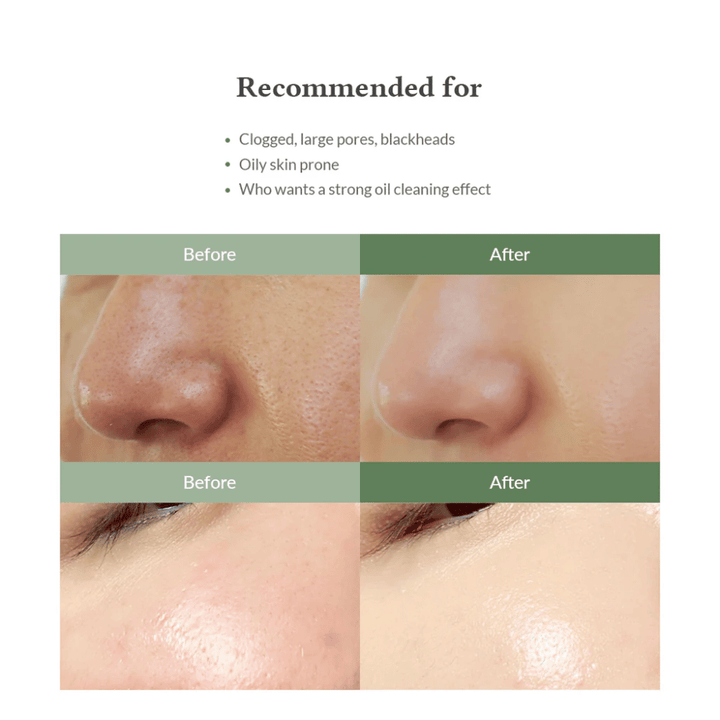 Dr. Althea Premium Quick Step Sebum Cleanser – kasvojen puhdistus, joka auttaa vähentämään mustapäitä, puhdistamaan huokosia syvältä ja antamaan tasaisemman ihon rakenteen.