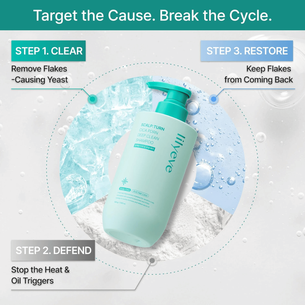 LILYEVE Scalp:Turn Cica PDRN Deep Clean Shampoo puhdistaa hiuspohjan, ehkäisee hilsettä ja liiallista talia sekä auttaa ehkäisemään oireiden uusiutumista.