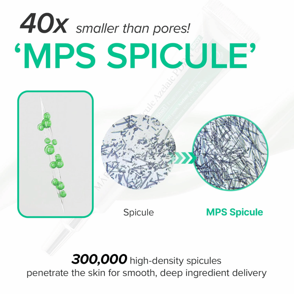 Mary&May Spicule Azelaic PDRN Spot Cream – MPS-spikulat aktiivisten ainesosien tehokkaaseen levitykseen